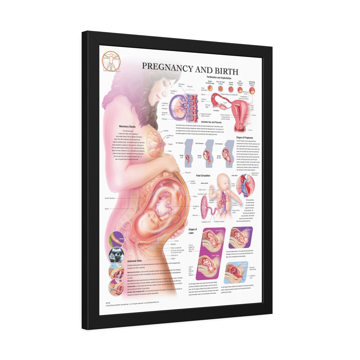 Framed Pregnancy and Birth