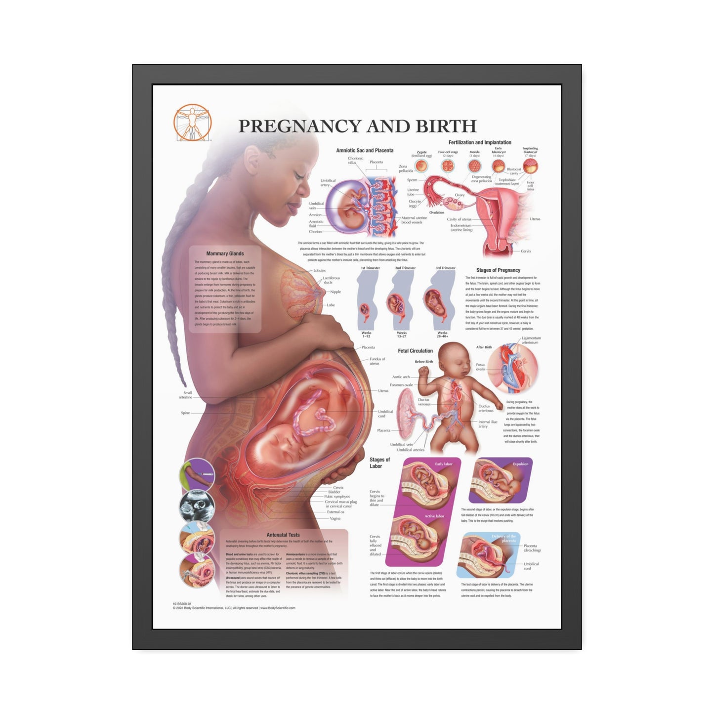 Framed Pregnancy and Birth