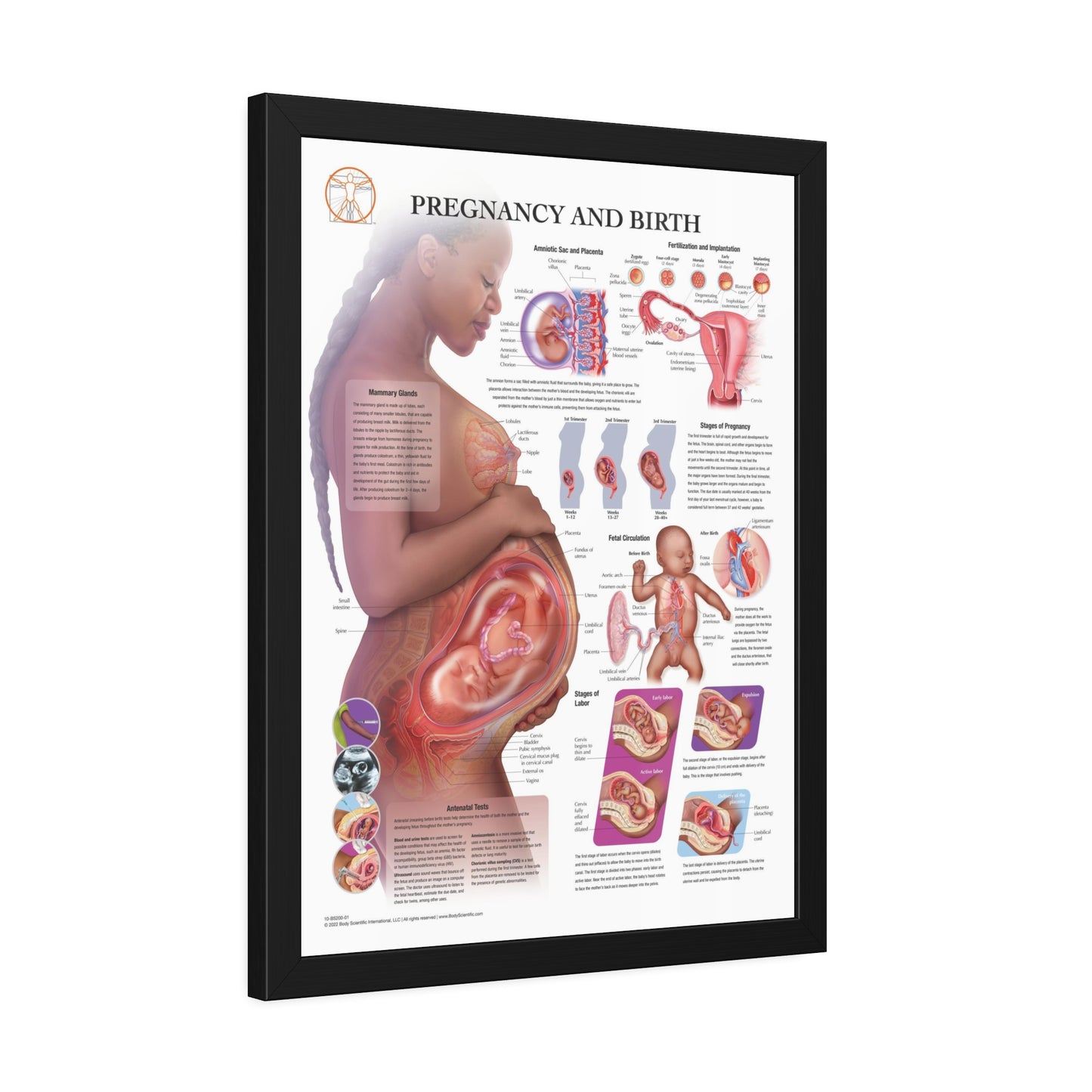 Framed Pregnancy and Birth