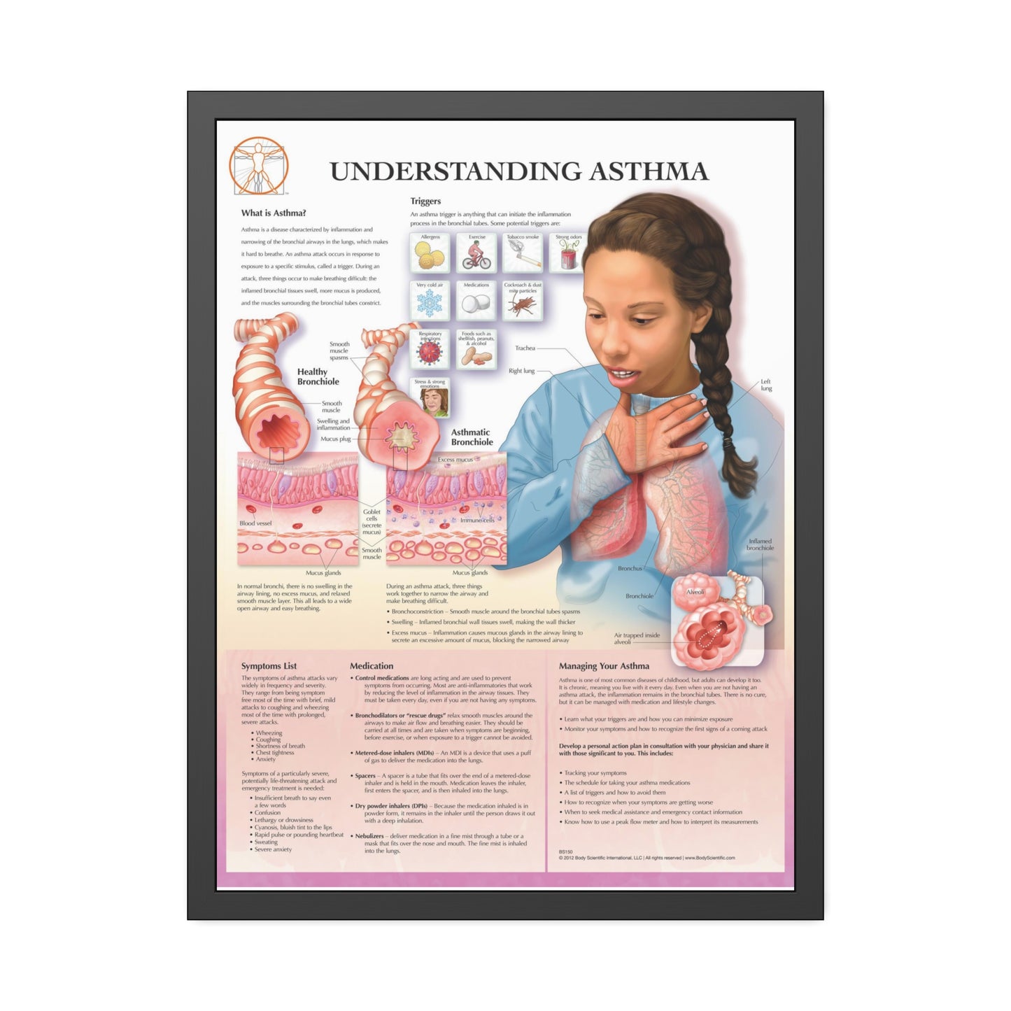 Framed Understanding Asthma