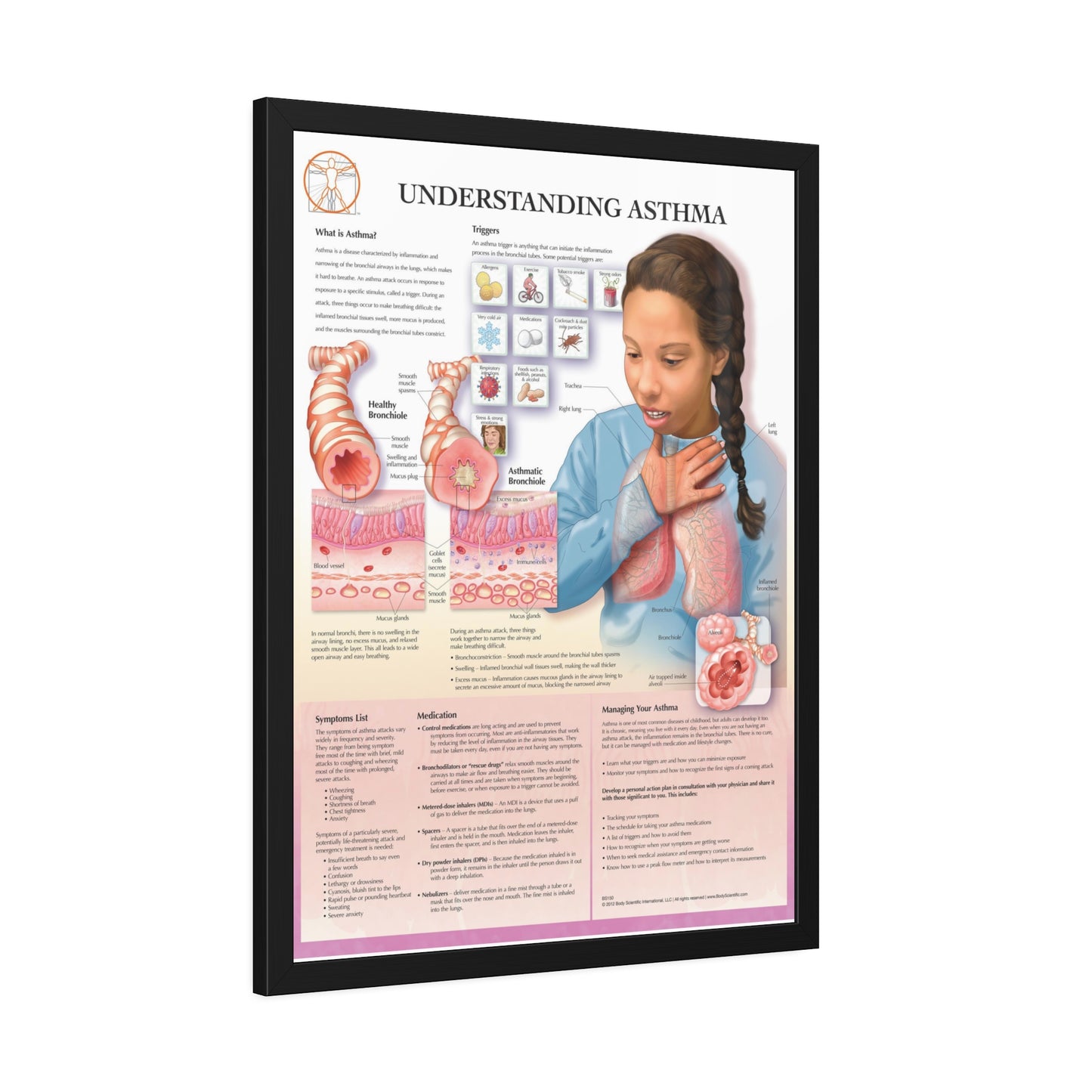 Framed Understanding Asthma