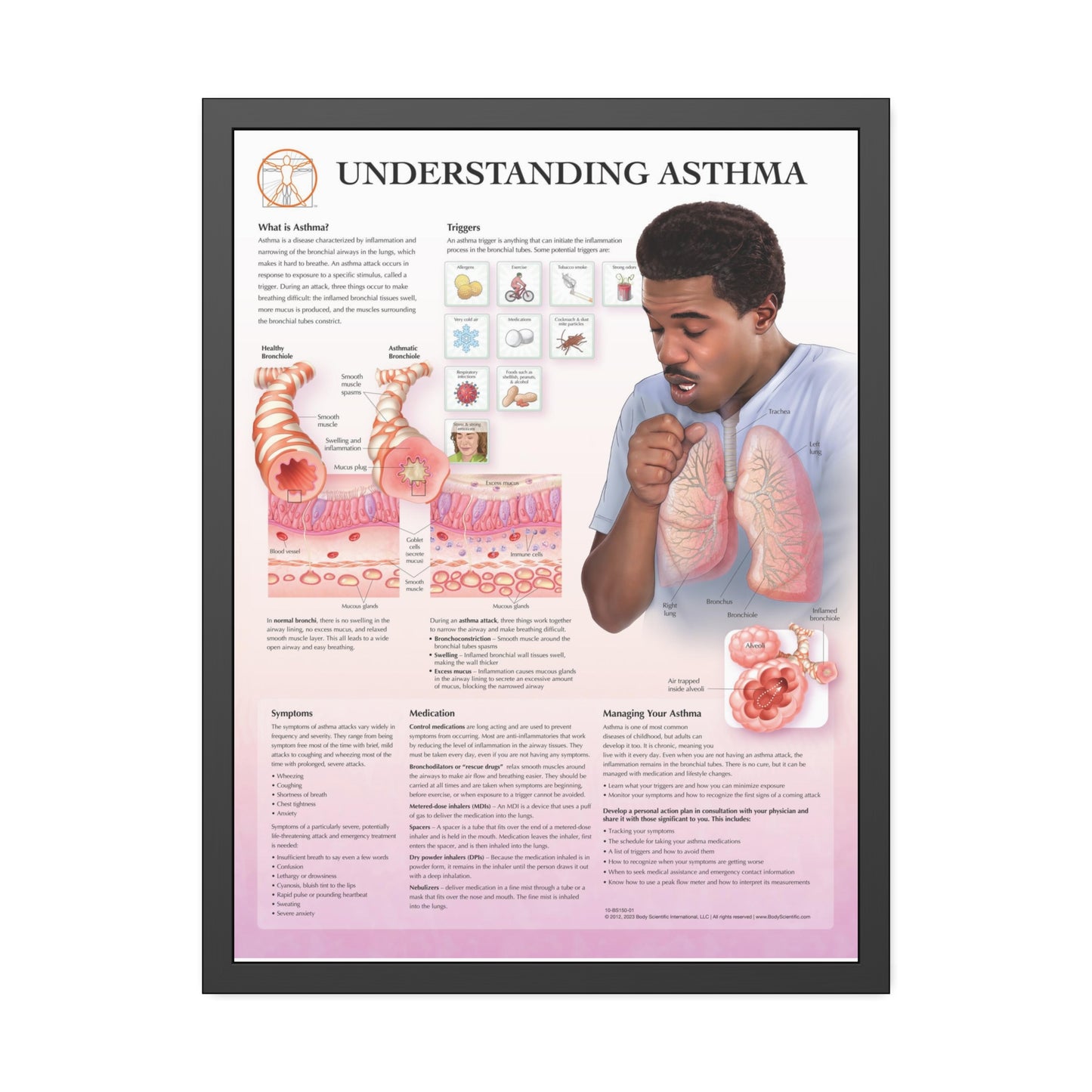Framed Understanding Asthma