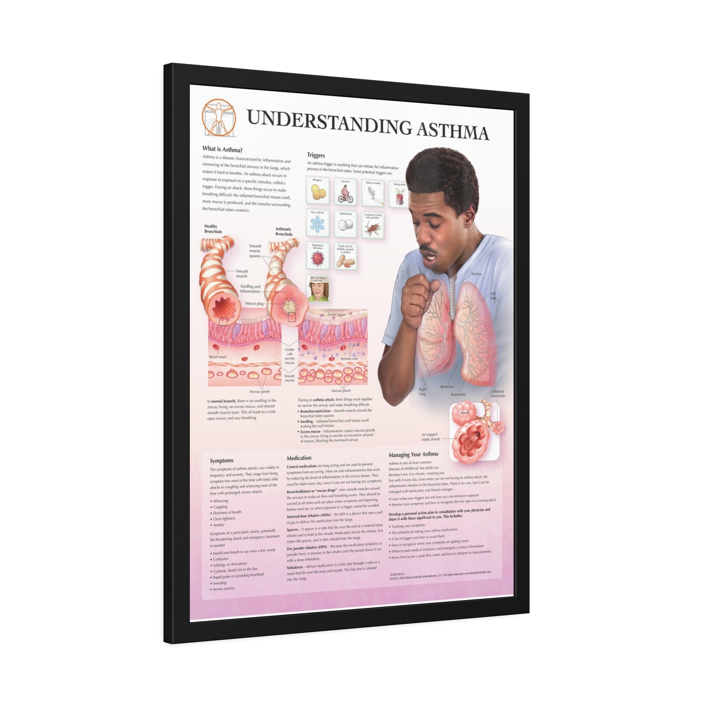 Framed Understanding Asthma