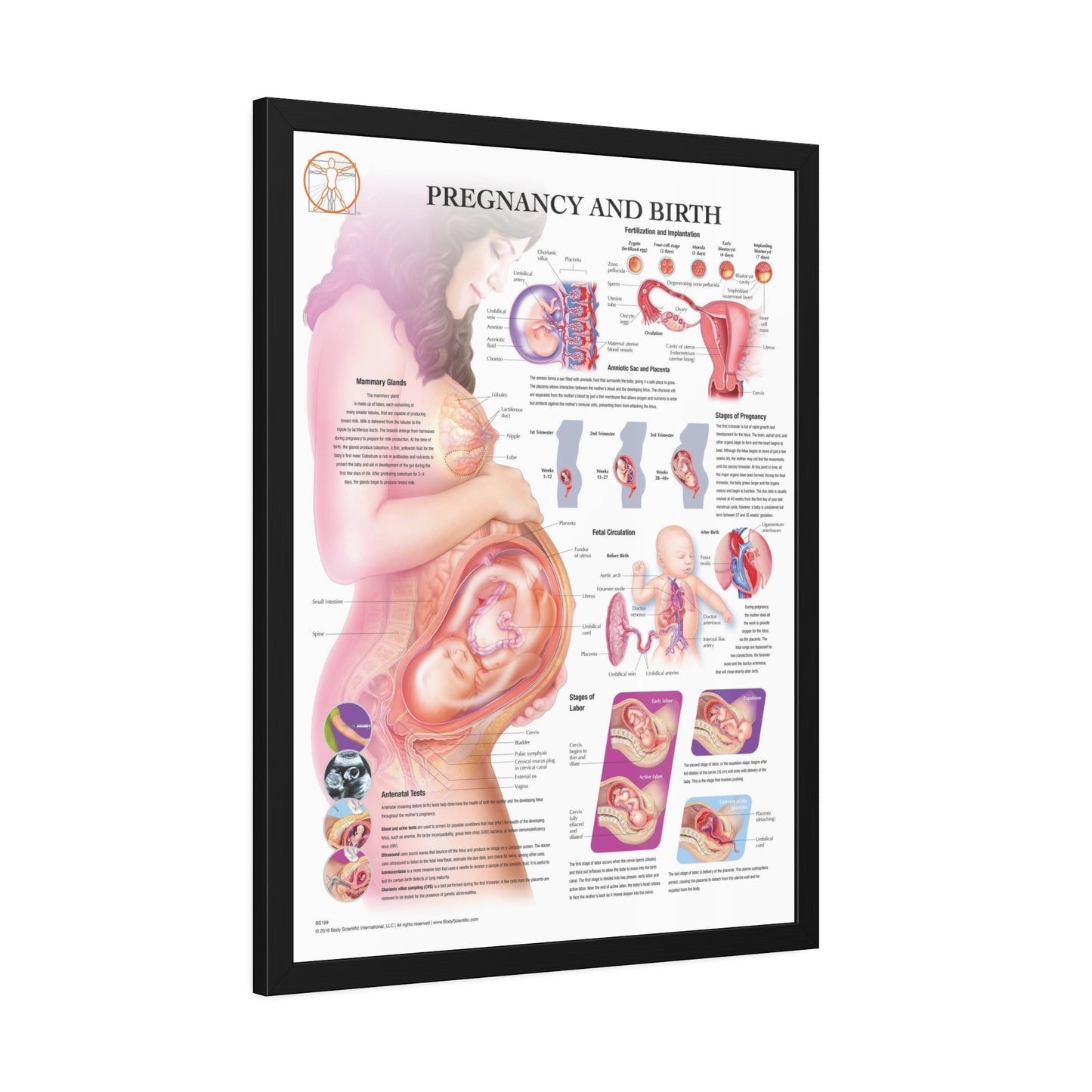 Framed Pregnancy and Birth