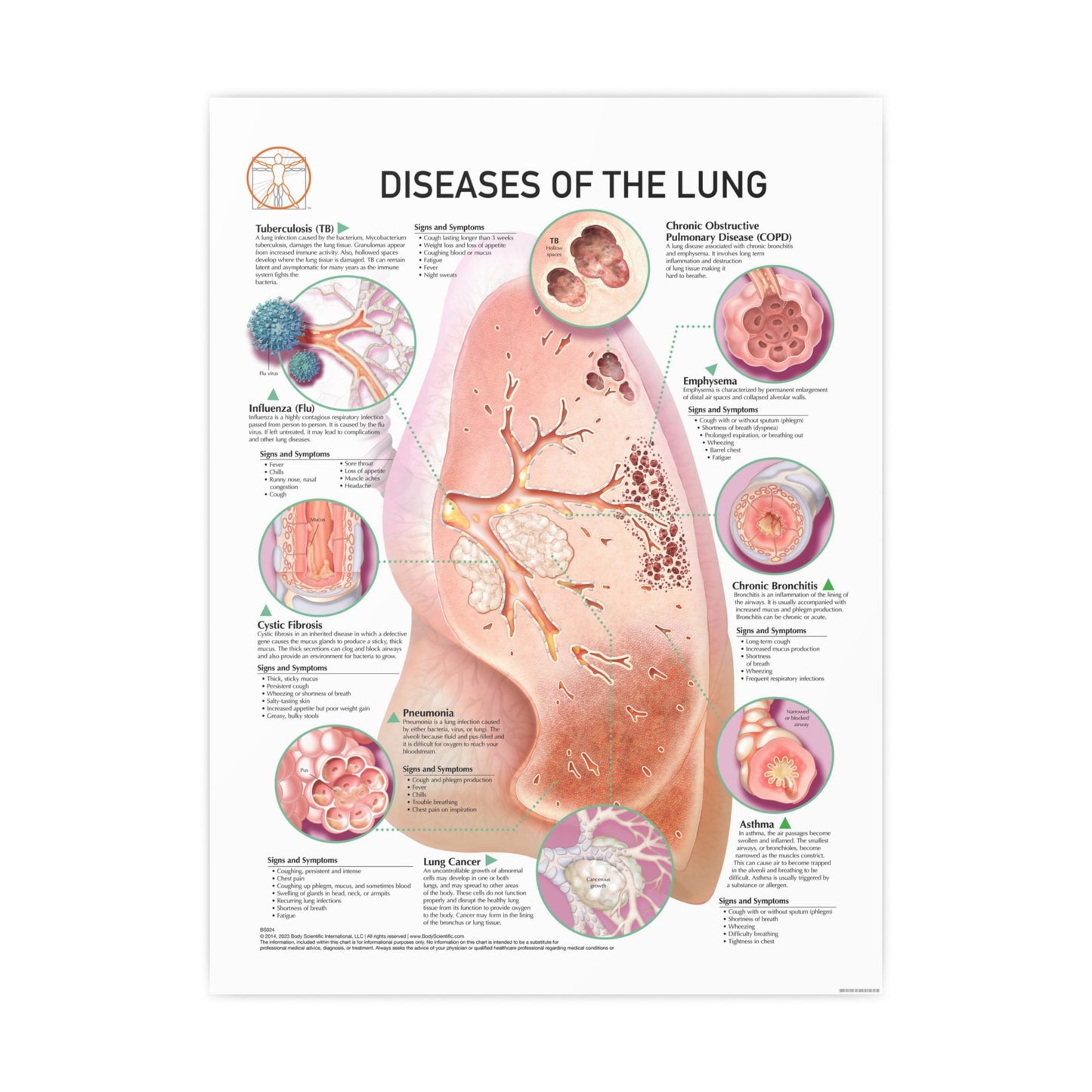 Diseases of the Lung