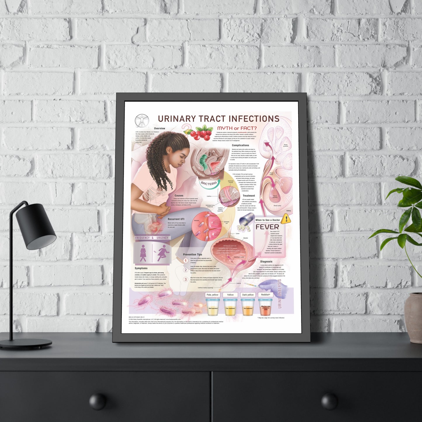 Urinary Tract Infection (UTI)