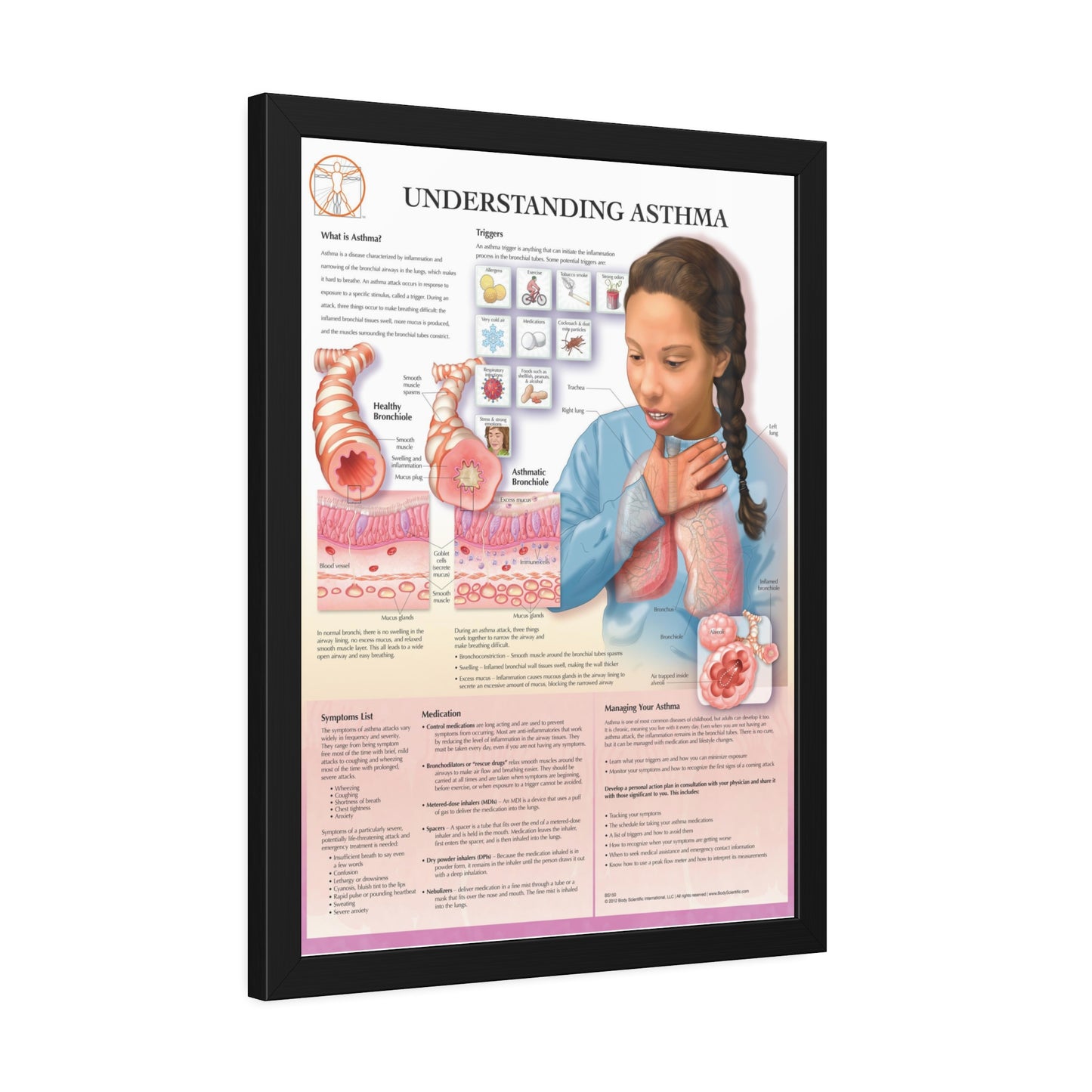 Framed Understanding Asthma