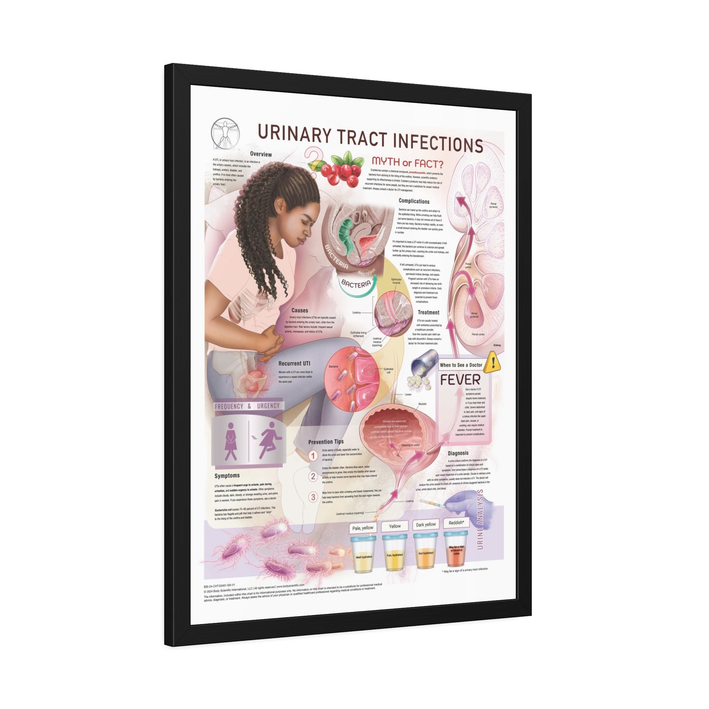 Urinary Tract Infection (UTI)