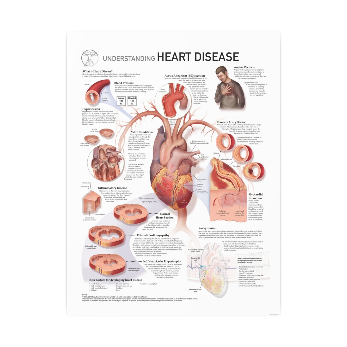 Understanding Heart Disease
