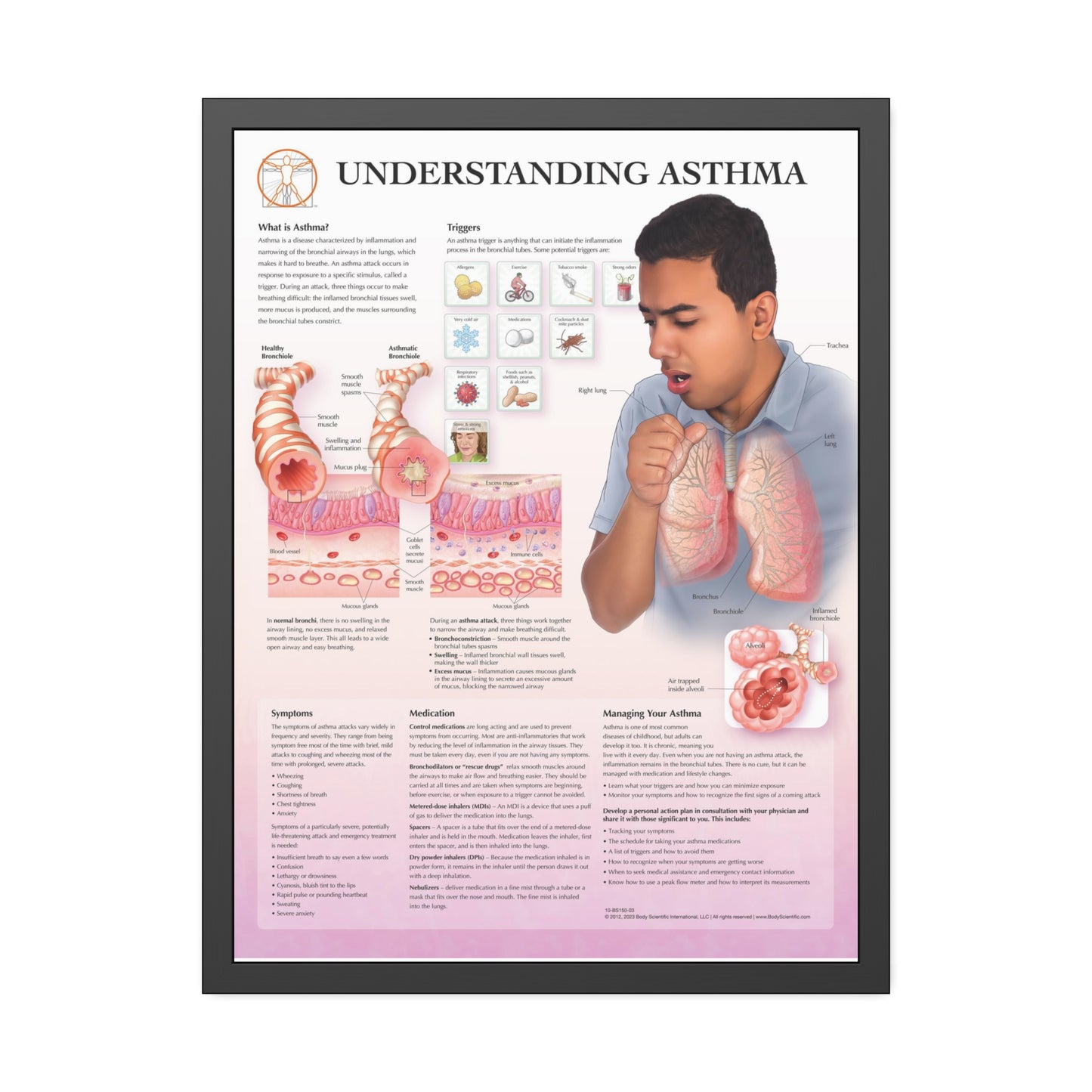 Framed Understanding Asthma