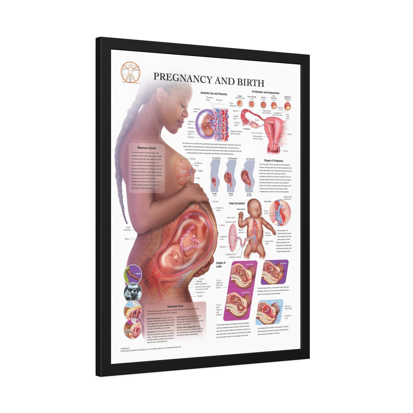 Framed Pregnancy and Birth