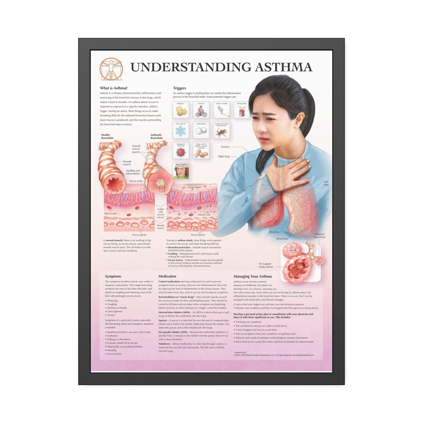Framed Understanding Asthma