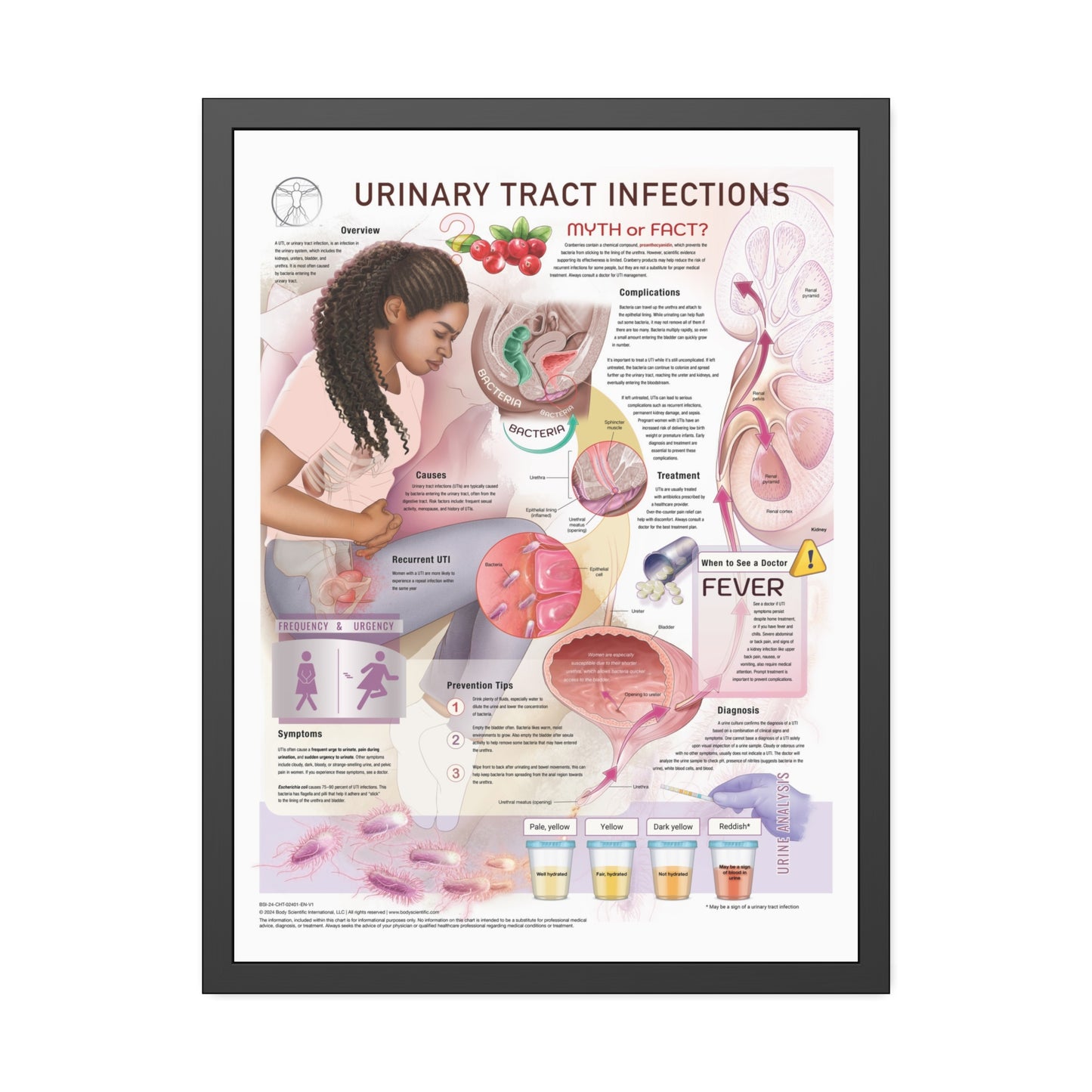 Urinary Tract Infection (UTI)