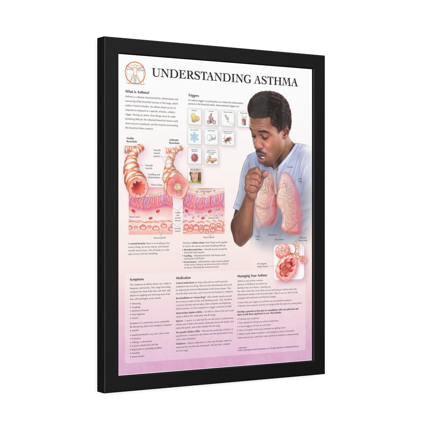 Framed Understanding Asthma