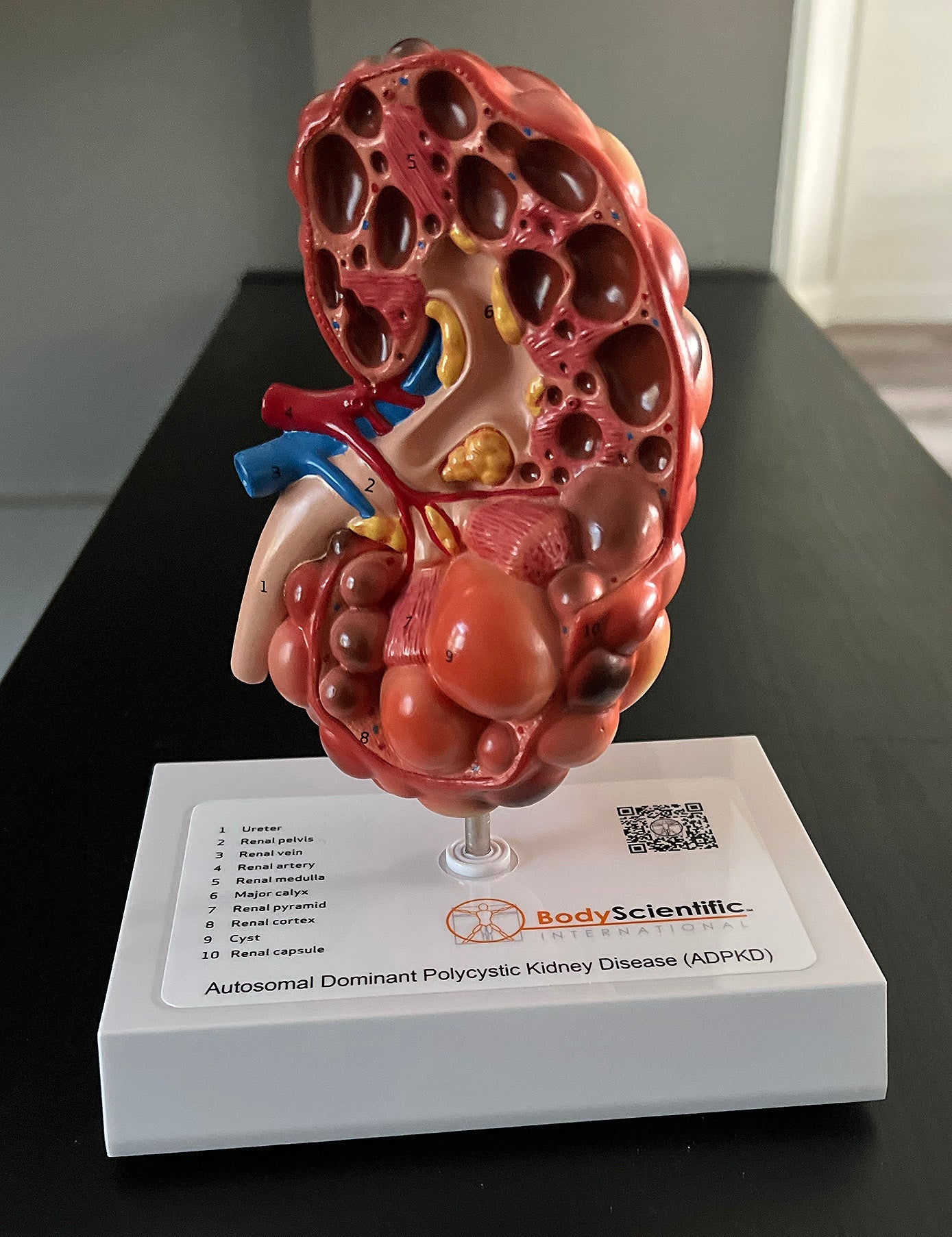 ADPKD Kidney
