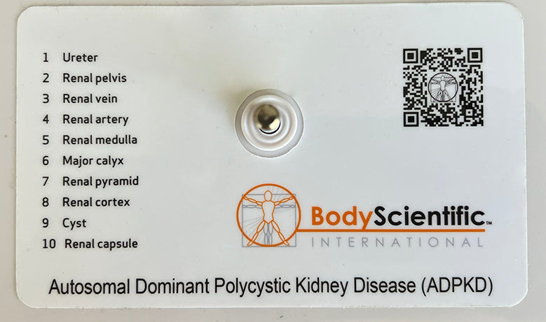 ADPKD Kidney