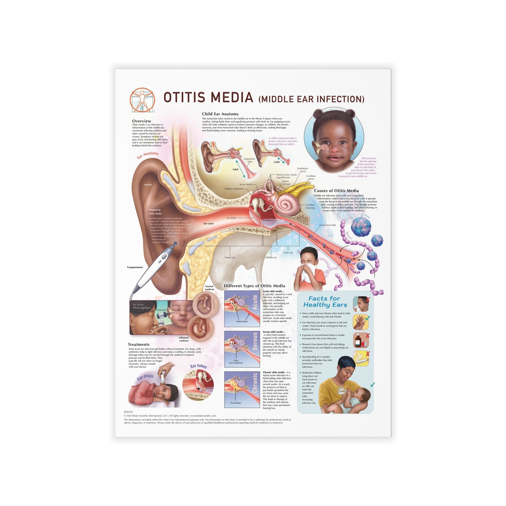 Otitis Inner Otitis Media (Middle Ear Infection) - Decal – Body Scientific