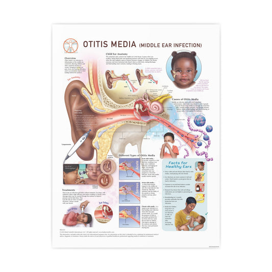 Otitis Media (Middle Ear Infection)
