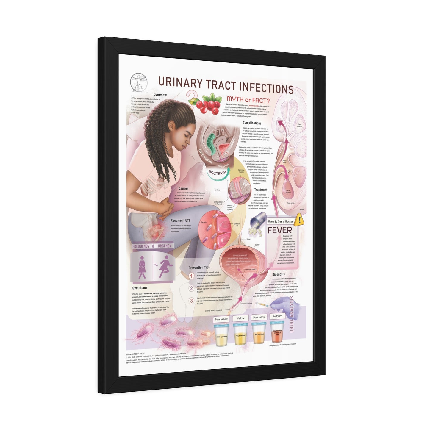 Urinary Tract Infection (UTI)
