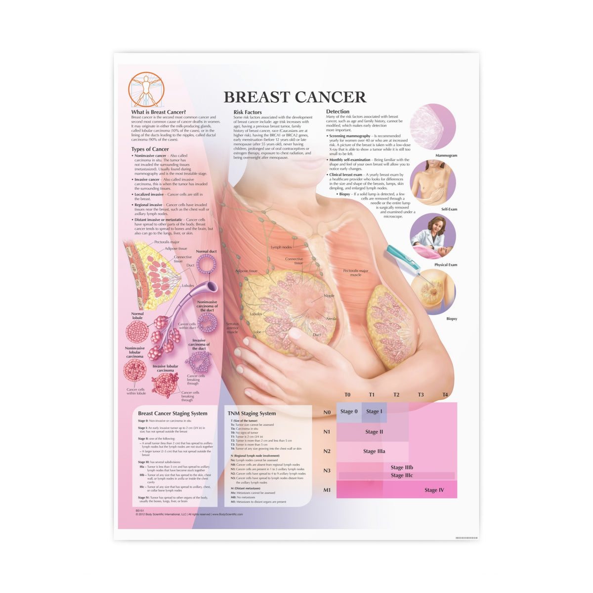 Breast Cancer Anatomical Chart