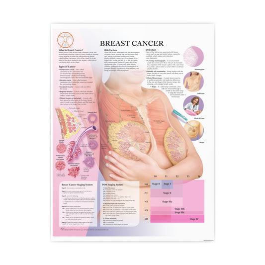 Breast Cancer Anatomical Chart