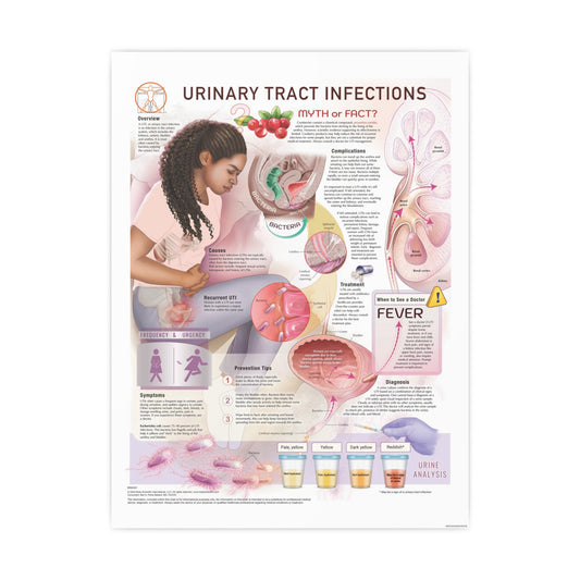 Urinary Tract Infection (UTI)