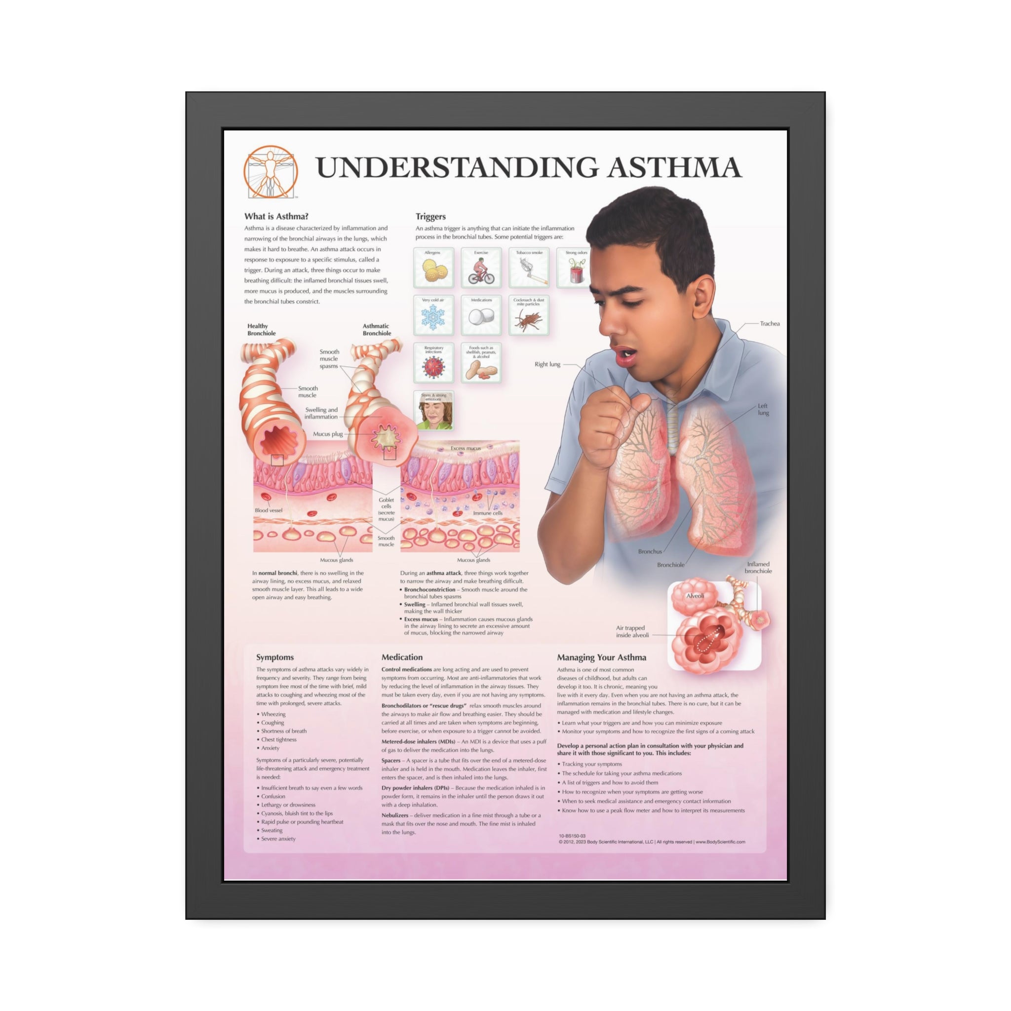 Framed Understanding Asthma – Body Scientific