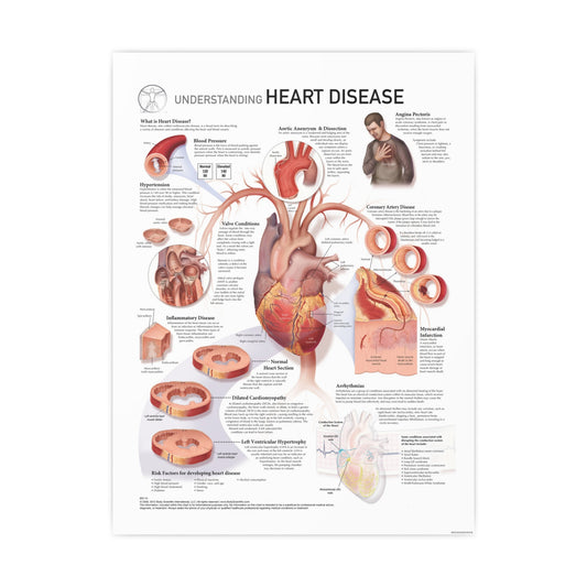 Understanding Heart Disease