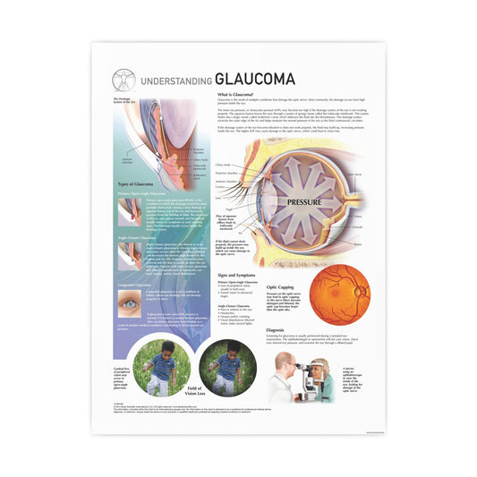 Understanding Glaucoma