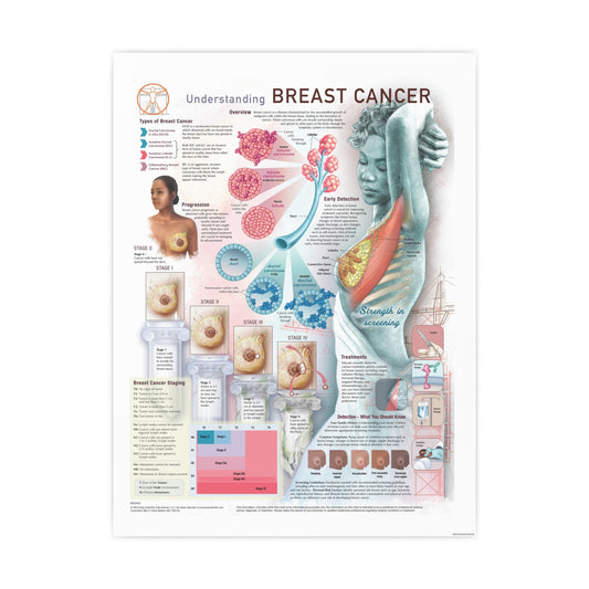 Understanding Breast Cancer