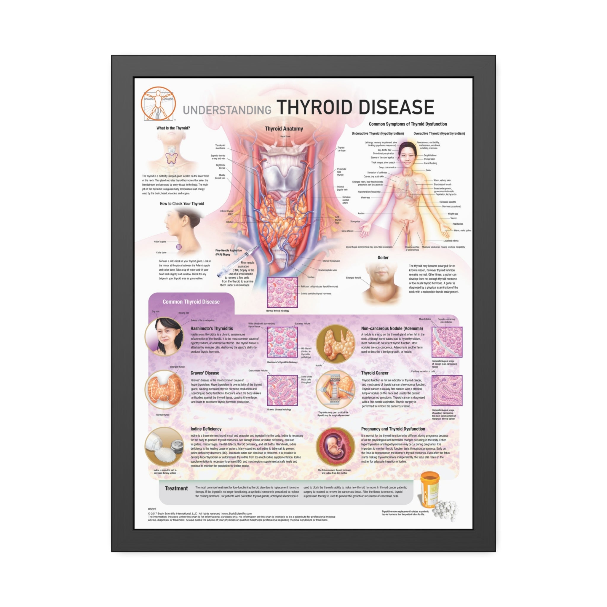 Understanding Thyroid Disease – Body Scientific
